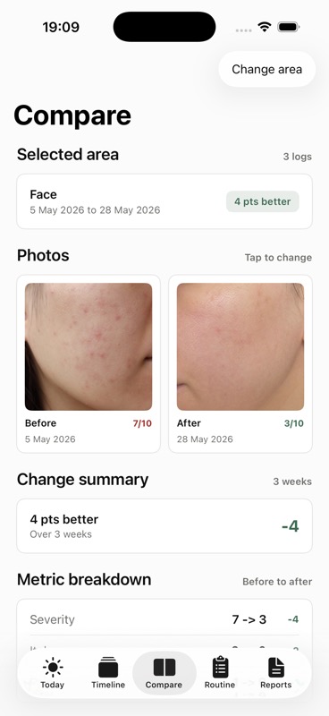 Skinfile Compare screen showing before and after skin photos with a change summary